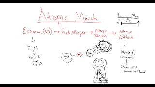 Atopic March  what causes it and what can you do about it [upl. by Aubarta]