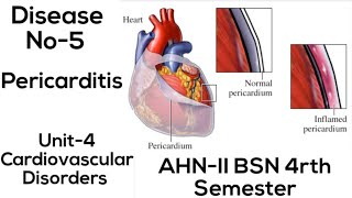 PericarditisDisease No5Unit4Cardiovascular DisordersAHNIIBSN 4rth semesterIn UrduEng [upl. by Anetta180]