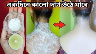 ১ দিনে  গলা ও ঘাড়ের জেদী কালো দাগ দূর হবেgola o gharer kalo dag dur korar upay Neck Whitening [upl. by Farrand311]