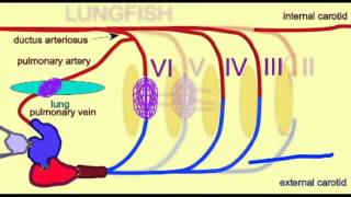 CVA3AORTIC ARCHESFROGavi [upl. by Eibbob]