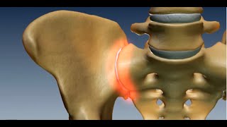 Where is the Sacroiliac Joint Anatomy of the Sacroiliac Joint [upl. by Erodroeht]