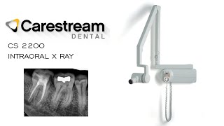 Carestream Dental CS 2200 Intraoral X Ray System [upl. by Heisser]