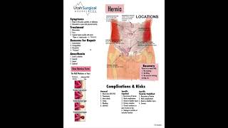 Inguinal amp Femoral hernia repair [upl. by Anaicilef]