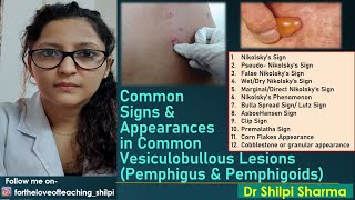 Signs in common Vesiculobullous Lesions Pemphigus amp Pemphigoids [upl. by Egiap]