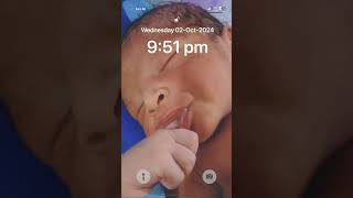 after birth baby hungry thumb sick 💞🤣shortvideo viralvideo fashortnewborn [upl. by Namaan]