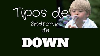 Tipos de síndrome de Down [upl. by Inama]