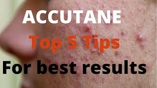 Accutane 5 tips by Dermatologists [upl. by Madson593]