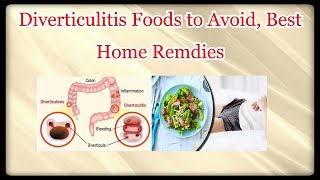 Diverticulitis Foods to Avoid Best Home Remdies [upl. by Kimbell]