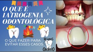 O que é Iatrogenia Odontológica [upl. by Nayrb283]