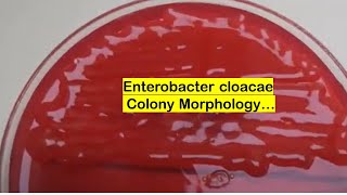 Enterobacter cloacae growth on CLED agar of Urine Culture [upl. by Lledualc]