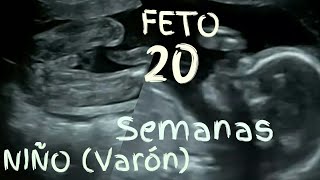 Es niño ❤️❤️ FETO 20 SEMANAS EMBARAZO 🤰 Desarrollo video ecografía en 3d💖 5º mes [upl. by Araeit]