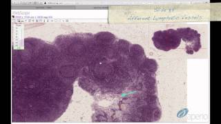 Histology Helper  Lymphoid Tissue Histology [upl. by Ainattirb708]