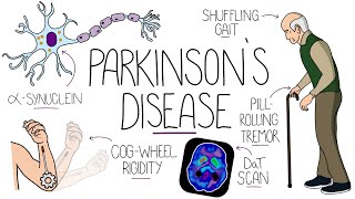 Understanding Parkinsons Disease Including Direct and Indirect Pathways [upl. by Nairret]