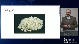 Bone Grafting Options and Evidence  Emmett Shearer PhD [upl. by Aihsekal]