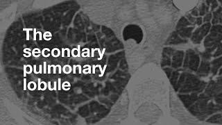 The Secondary Pulmonary Lobule [upl. by Ahsenet]