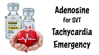 Treating Supraventricular Tachycardia SVT with Adenosine [upl. by Phebe]