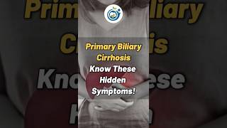 Primary Biliary Cirrhosis Hidden Symptoms cirrosis gastroenterologist viralshorts doctor [upl. by Anierdna929]