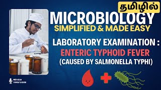 Hemoculture🩸 examination 🧪in Enteric Typhoid Fever 🤒 EASY EXPLANATION தமிழில்  Microbiology 🧫 [upl. by Eliot]