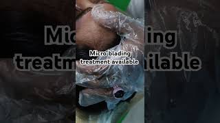 micro blading treatment [upl. by Amsirac]