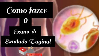 COMO FAZER O EXAME DE EXUDADOVAGINAL [upl. by Eeryk729]