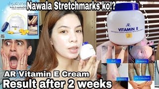 AR VITAMIN E CREAM RESULT AFTER 2 WEEKS Nawala Stretchmarks ko [upl. by Sloane895]