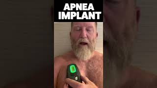 ⚡️Inspire Sleep Apnea Implant Activation By Doug shorts⚡️ [upl. by Hansel]