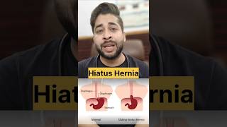 The Complete Guide to Hiatus Hernia What You Need to Know [upl. by Ahseenal]