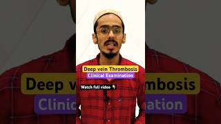 Deep vein thrombosis clinical examination shorts deepveinthrombosis dvt [upl. by Anivel]