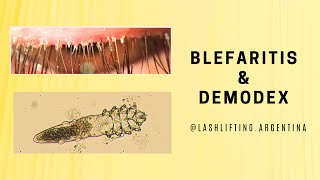 Blefaritis y Demodex liftingdepestañas lashlifting [upl. by Cartie]