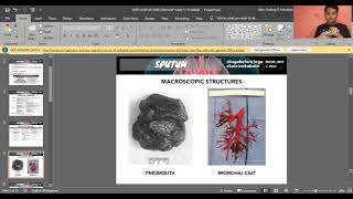 MT 51 Didactics  Clinical Microscopy Review Sputum Bronchoalveolar Lavage amp Sweat [upl. by Wolfy]