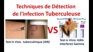 Quelle Méthode Fiable des Techniques de Détection de linfection Tuberculeuse latente IDR ou IGRA [upl. by Ynaffets370]