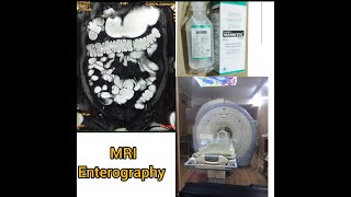 MRI Enterography planning and positioning on GE signa HDxt 15T [upl. by Aoht859]