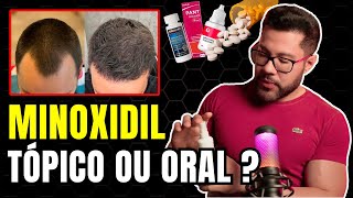 MINOXIDIL TÓPICO OU ORAL QUAL É MELHOR [upl. by Brook]