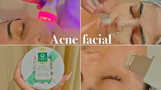 Professional Acne Facial Tutorial I Best For Blackheads Acne Scars amp Spots Oily Skin I HINDI [upl. by Cherry]