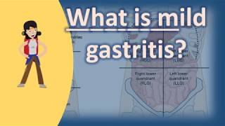 What is mild gastritis   Best and Top Health Answers [upl. by Daria]