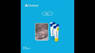 Case report  treatment of a Pressure Ulcer with Flaminal® [upl. by Cir]