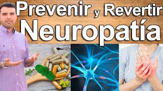 ELIMINE SU NEUROPATIA  Neuropatía Diabética y Periférica  Estilo de Vida Dieta y Suplementos [upl. by Eliathas]