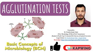 Agglutination tests I Immunology I Hemagglutination tests I Hemagglutination Inhibition tests I [upl. by Yelsek]