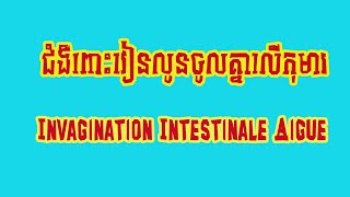 IIA invagination intestinale aigueពោះវៀនលូនចូលគ្នា [upl. by Faro33]