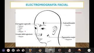 Electrocardiograma y Electromiograma [upl. by Dnomar]