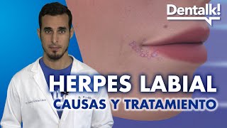 Tratamiento del HERPES LABIAL causas y síntomas de la CALENTURA en el labio  Dentalk © [upl. by Ahsaret]