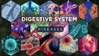 Digestive Diseases Explained  Causes Symptoms amp Treatments [upl. by Lasky]