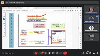 HERNIA CRURAL FEMORAL E HIPOGASTRICA [upl. by Reave612]