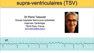 6a Classification des tachycardies supraventriculaires ECG Dr Taboulet [upl. by Pathe939]