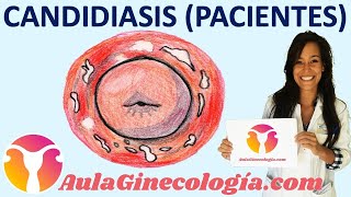 CANDIDIASIS VAGINAL PACIENTES Causas síntomas tratamiento  Ginecología y Obstetricia [upl. by Udelle]