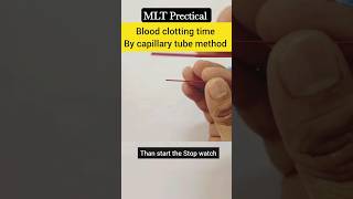 Blood clotting time by capillary tube methodCT test mlt dmlt labtechnician shorts [upl. by Nordek586]