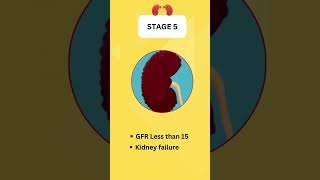 End Stage Renal Disease Stages [upl. by Mchail]