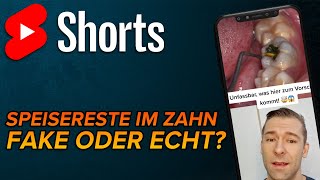 Was im hohlen Zahn shorts [upl. by Akoek555]