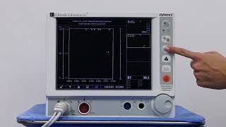 Vigilance II monitor Intermittent Thermodilution Cardiac Output with COSet system [upl. by Thelma835]