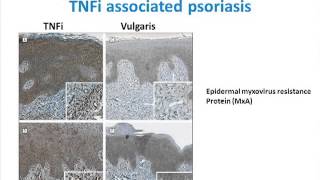 Paradoxical Safety Signals from Biologics [upl. by Atnahsal]